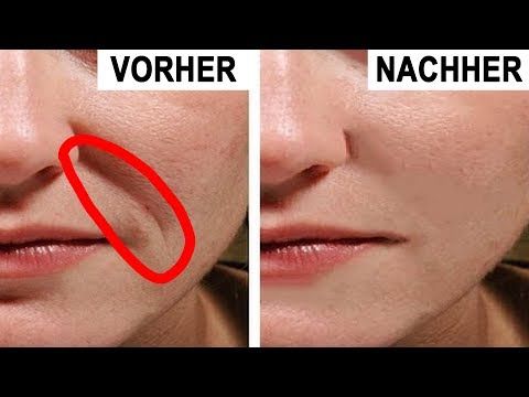 Was hilft gegen Falten und schlaffe Haut?